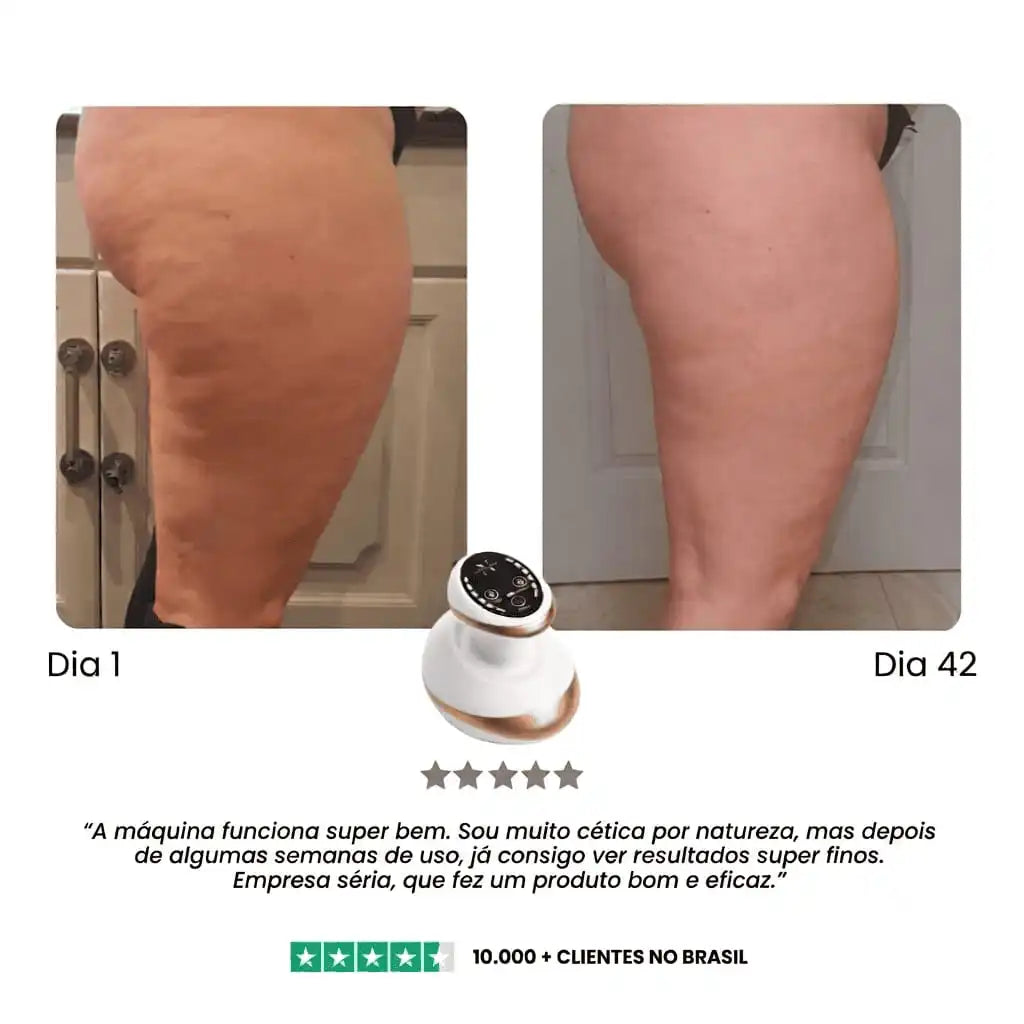 DermaShape™ Anti-Celulite